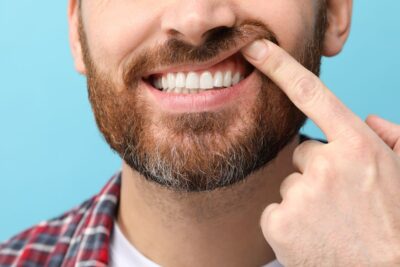 Man pointing to his gums
