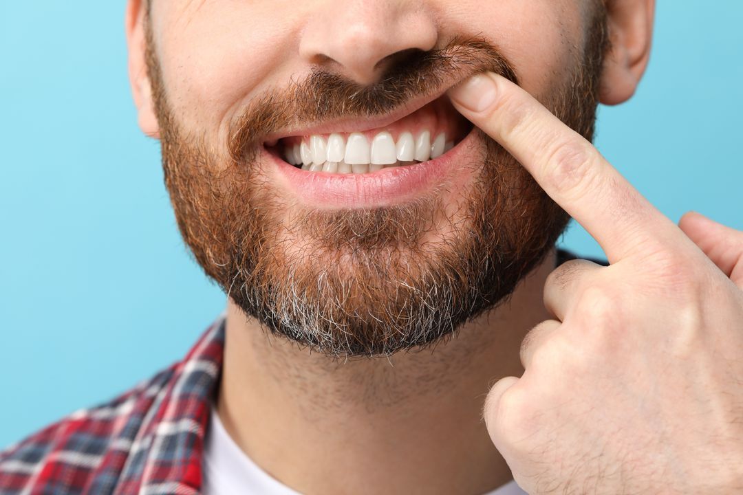 Man pointing to his gums