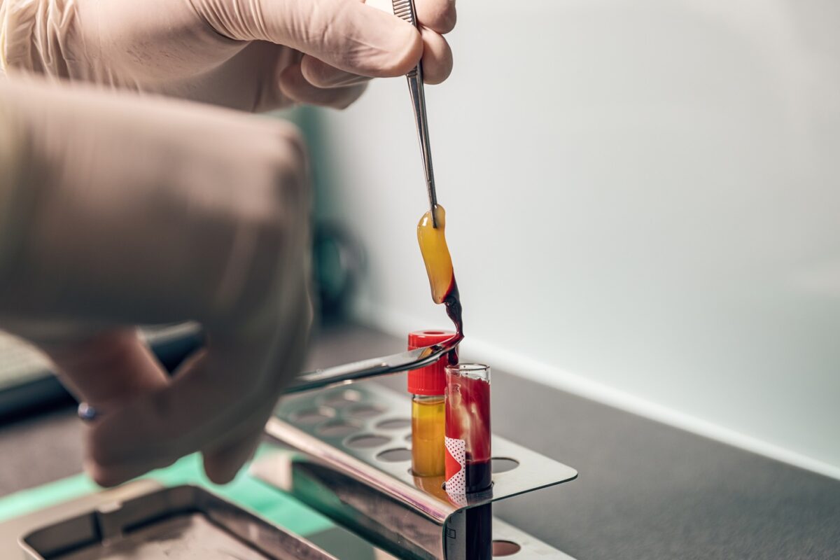 Blood sample being run through a centrifuge